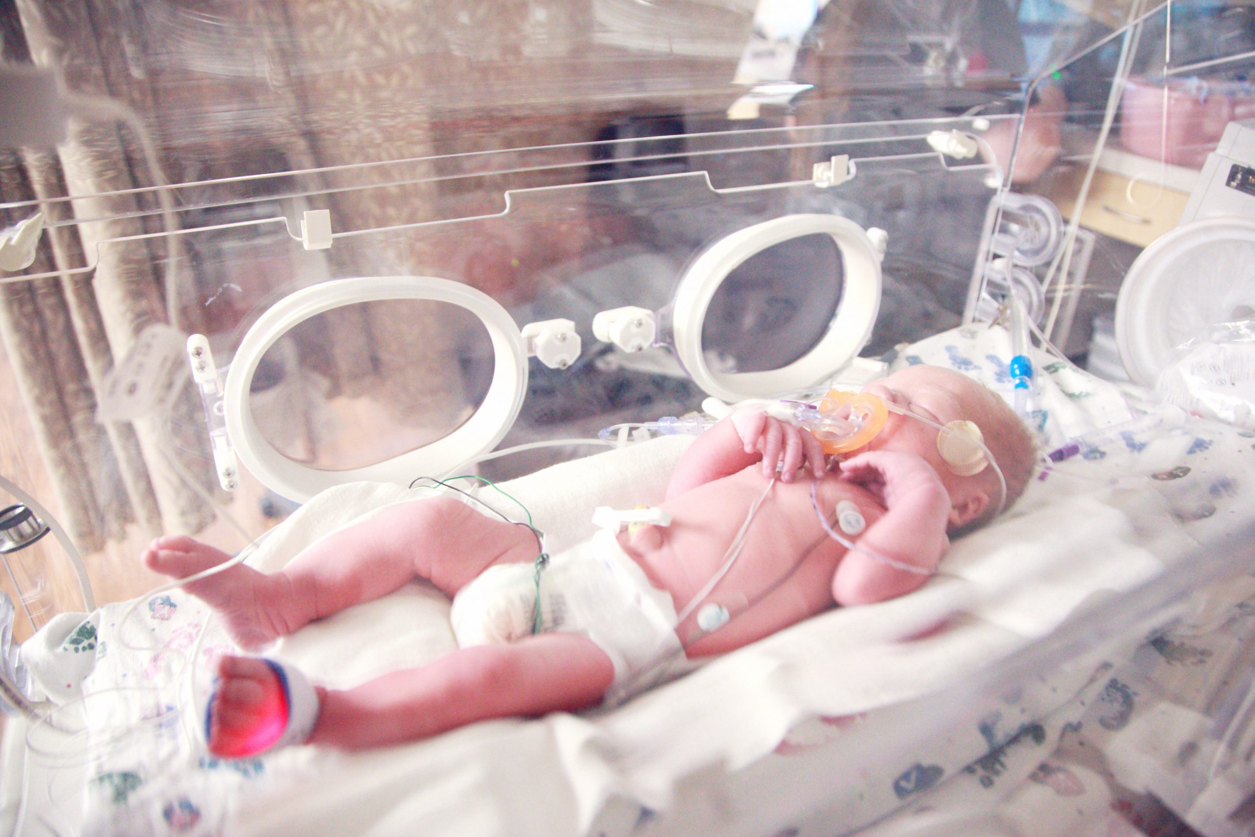 Neonatologie onderzoek OLVG IMH Nederland